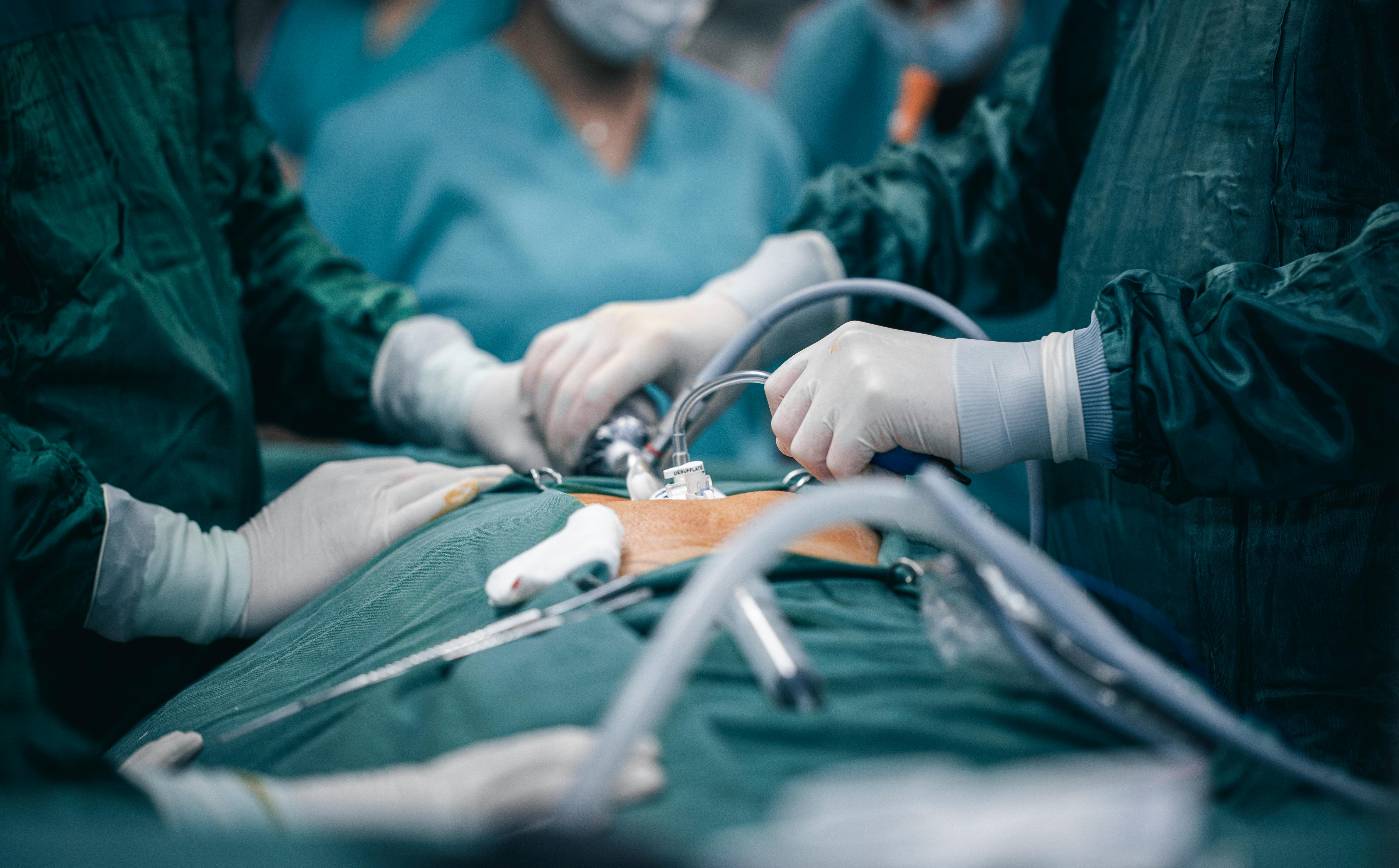 Laparoscopic Surgery