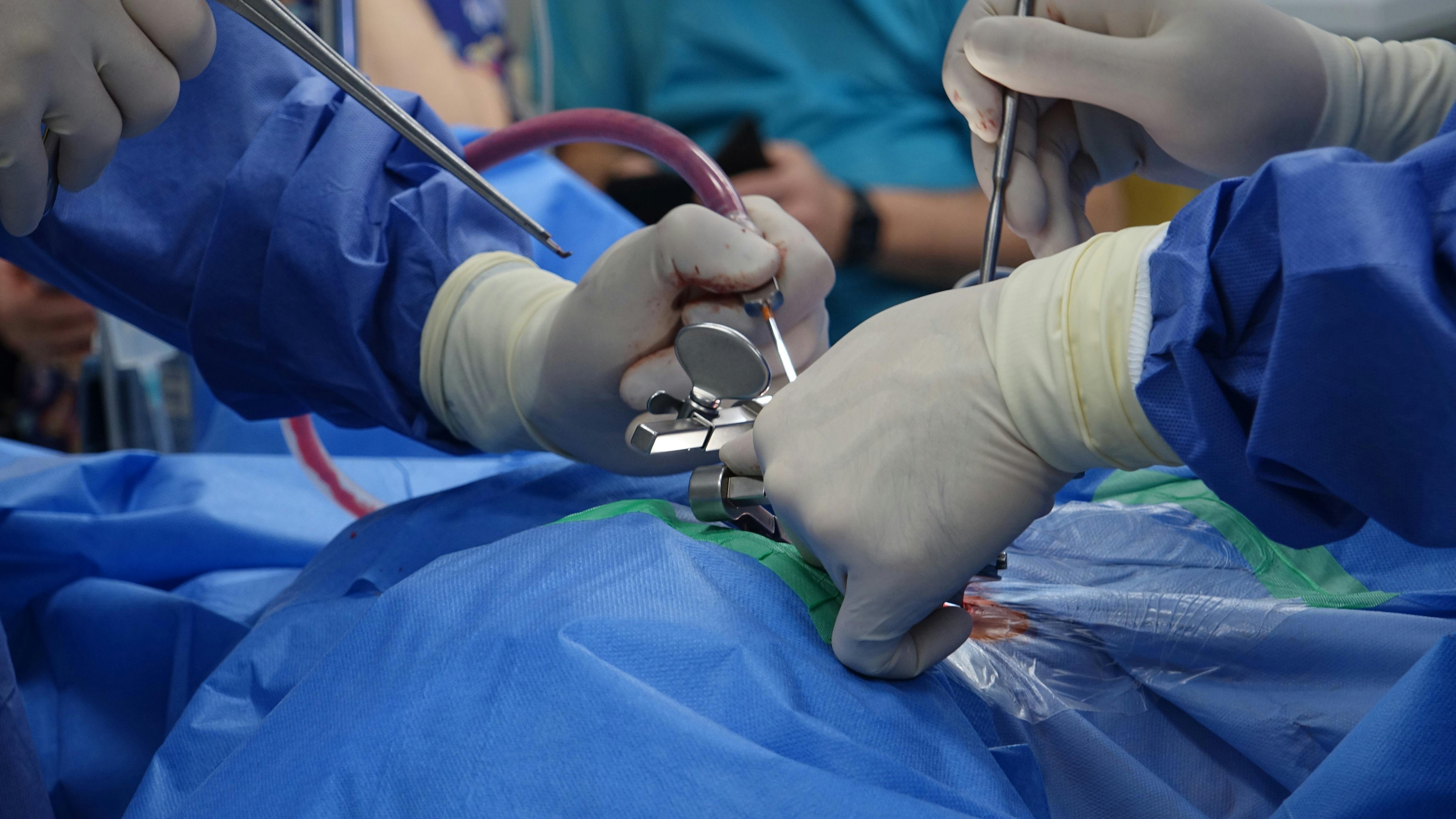 Laparoscopic Surgery at Sebbi Hospital