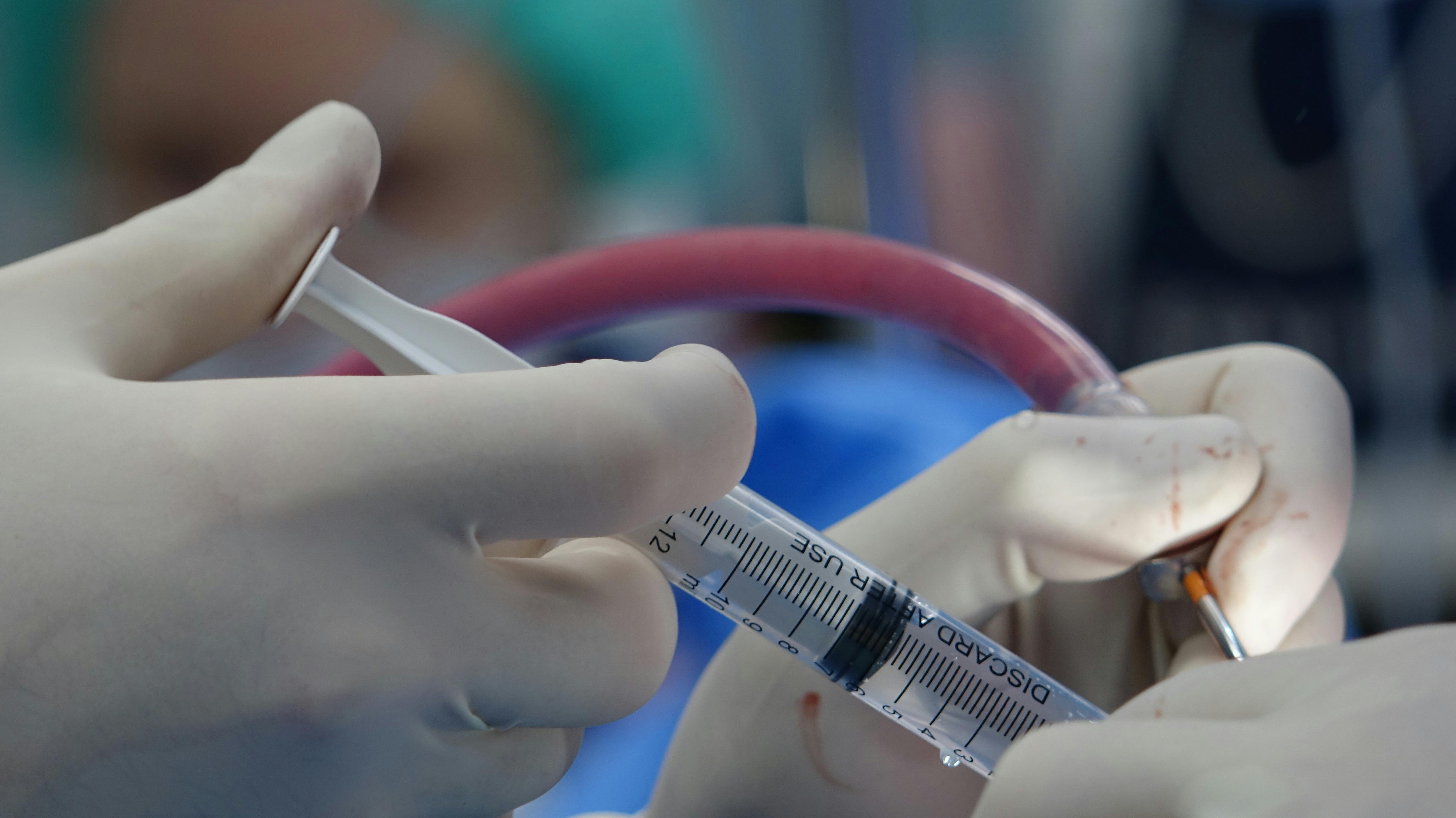 Epidural Analgesia in Labour