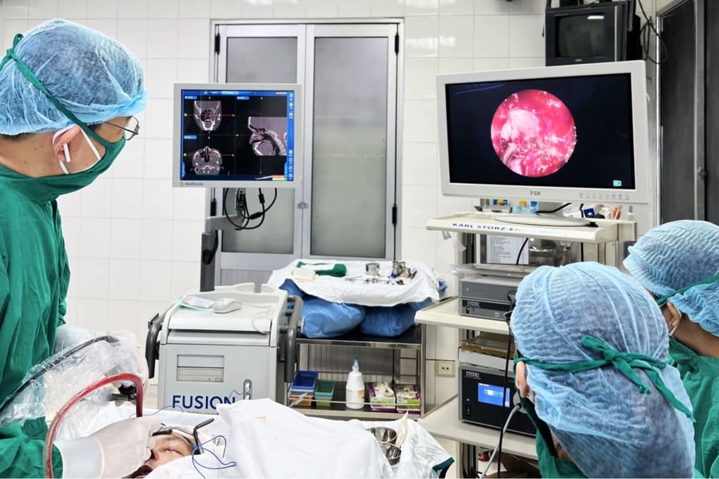 Bác sĩ tiết lộ nguyên nhân 269 ca mổ nội soi mũi xoang ở TPHCM thất bại - 1