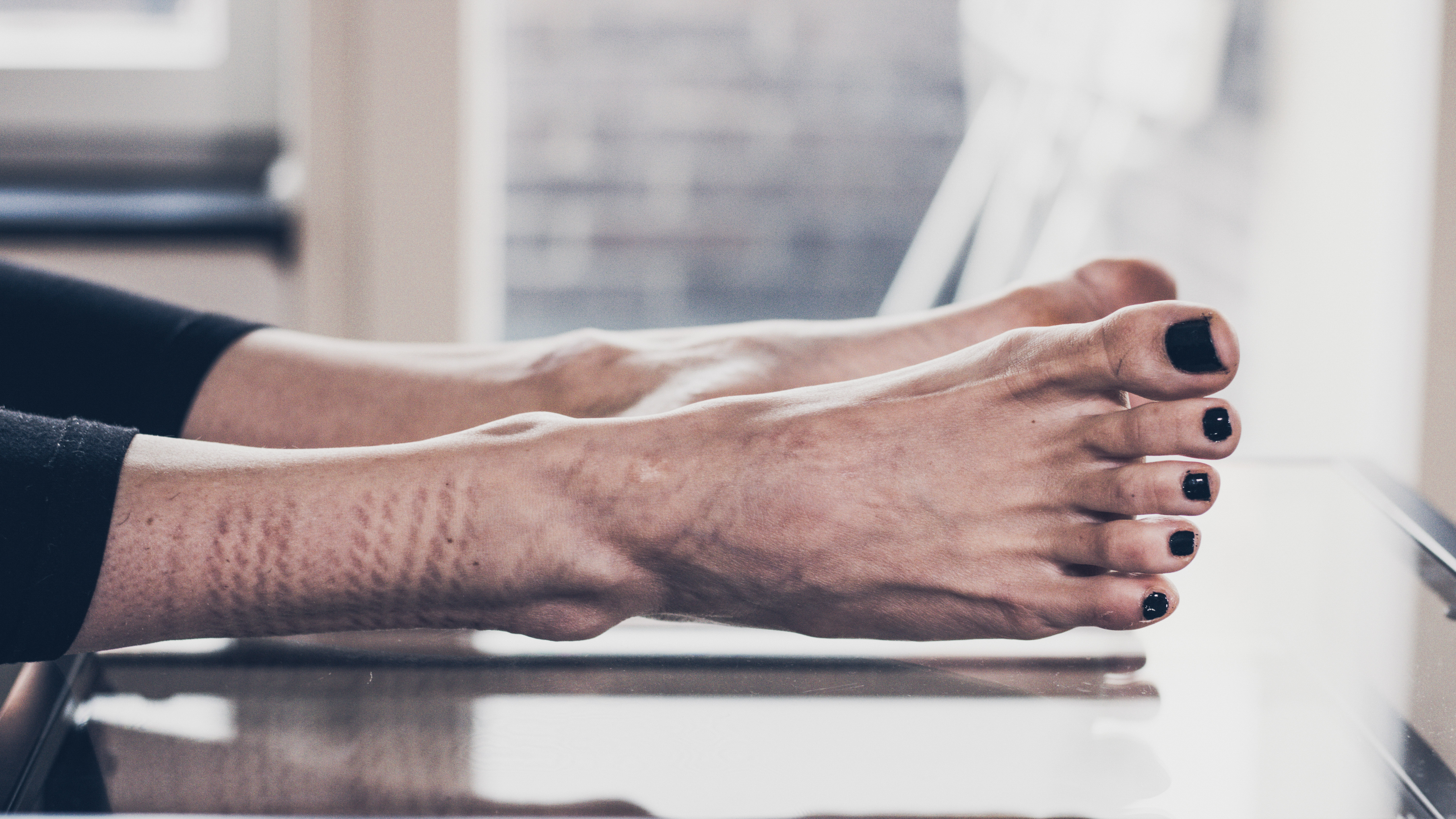 a woman's feet on a with shibari rope marks on her ankles