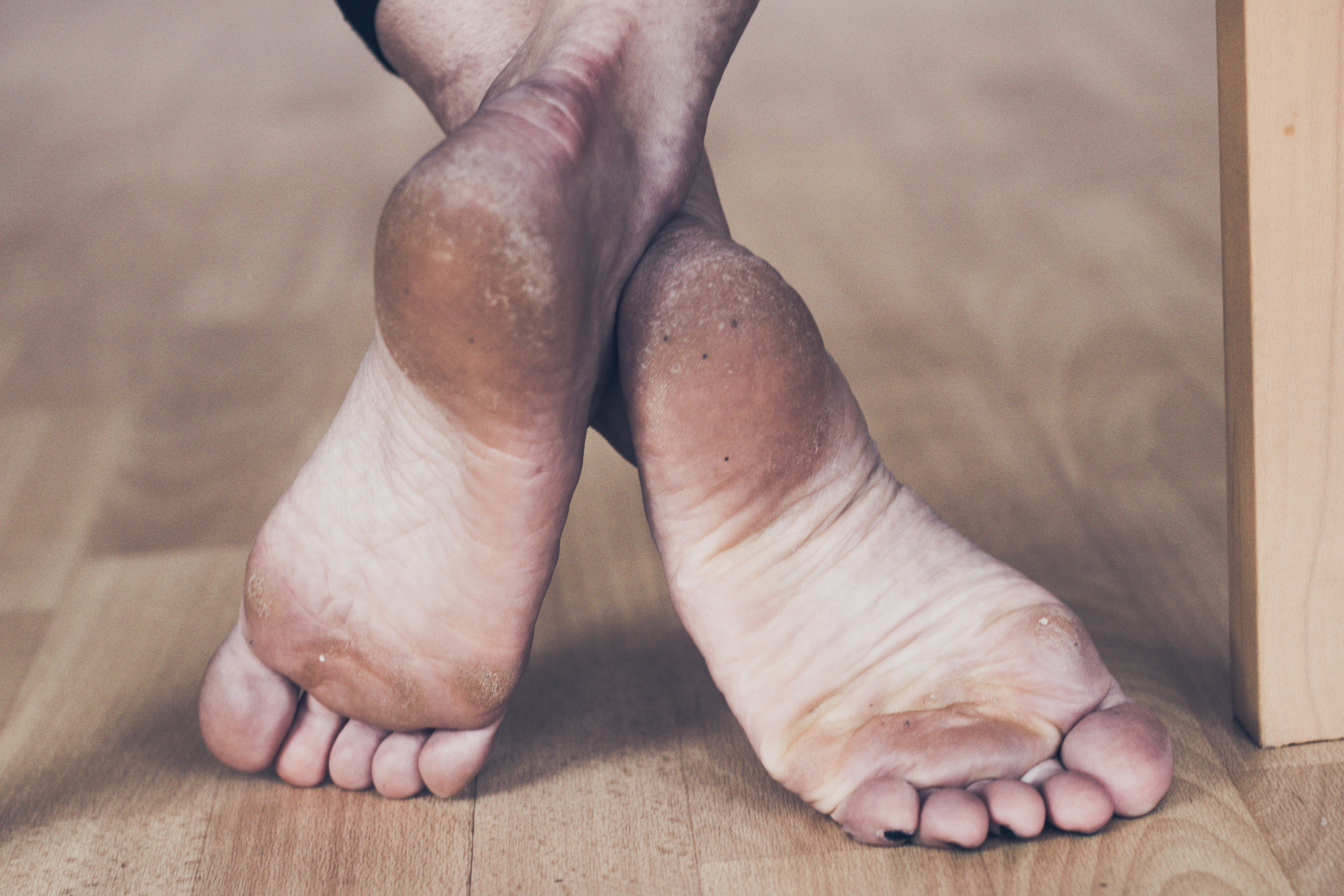 a woman's feet under a chair with her ankles crossed