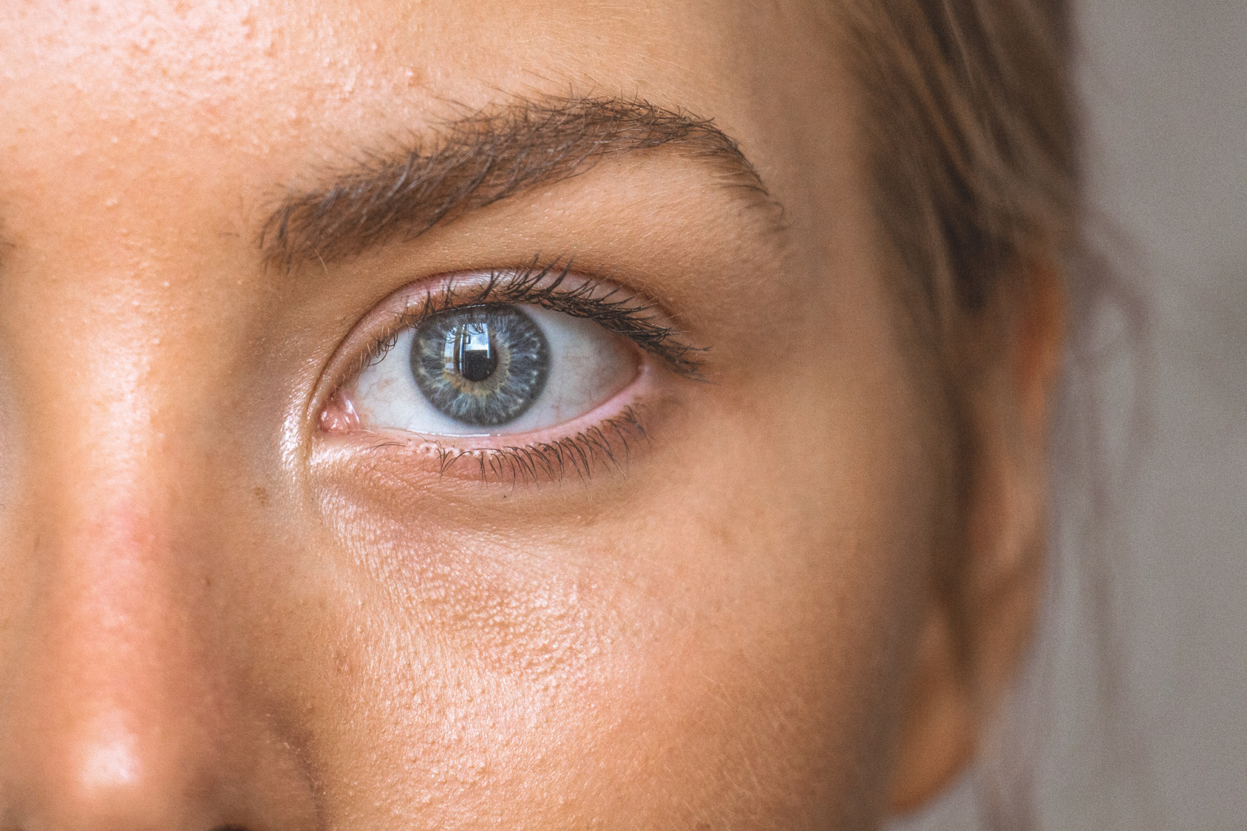 An extreme close up of a woman with blue eyes staring at the camera, demonstrating how stress can cause acne