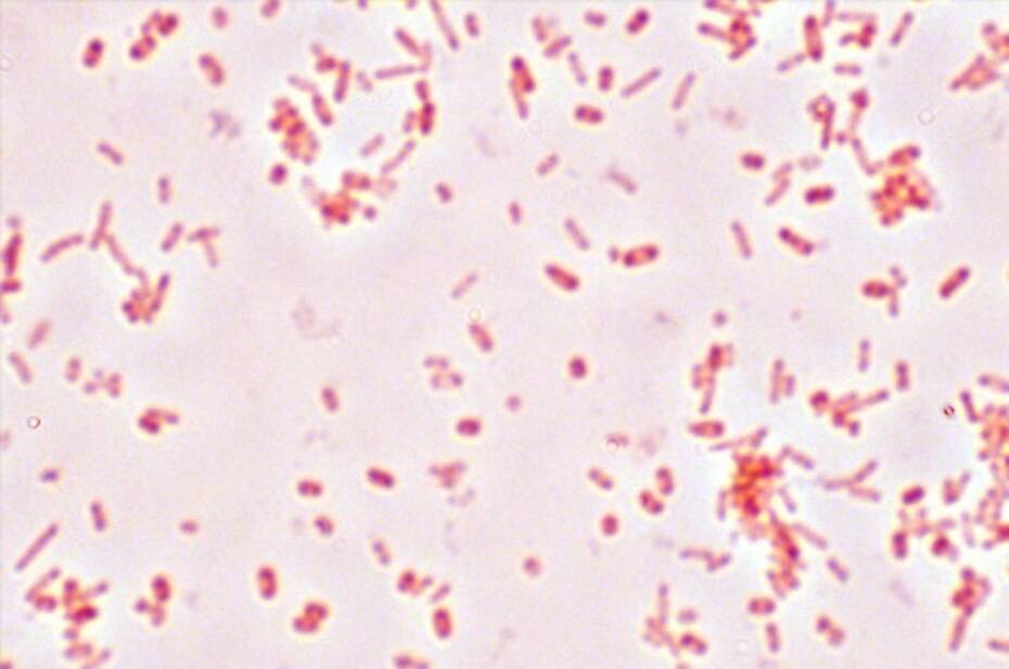 بكتيريا الأمعاء