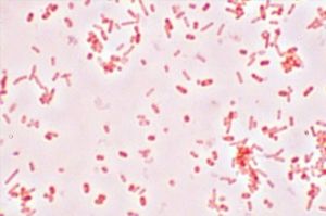 بكتيريا الأمعاء