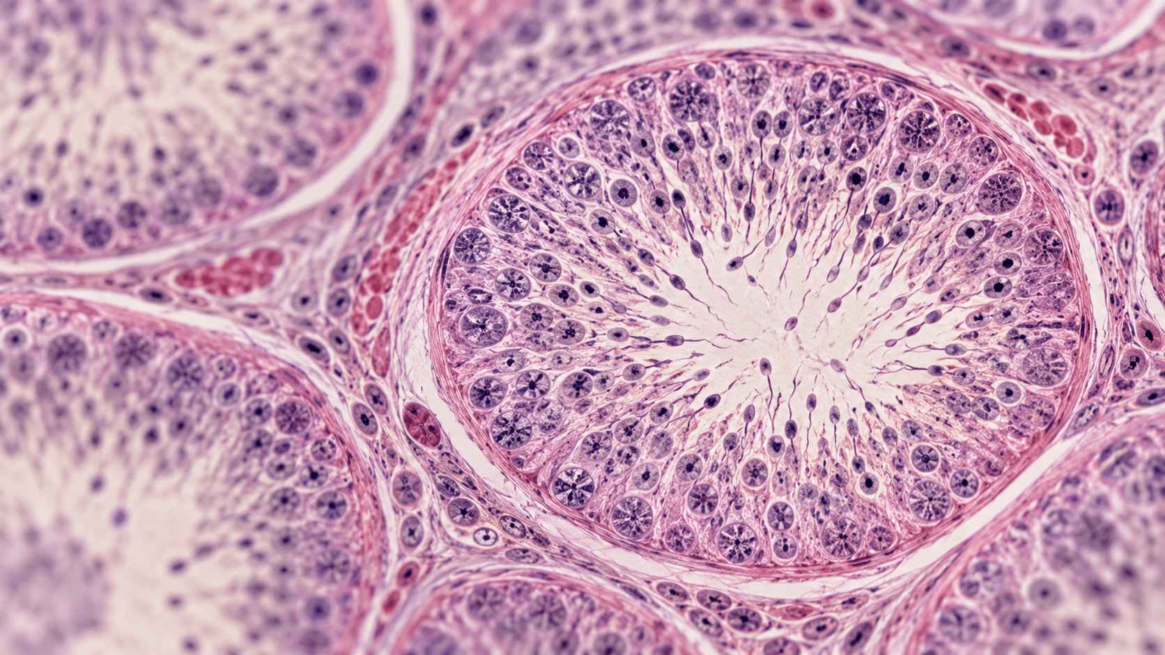 Sperm Count, Motility, and Morphology: What the Results Mean