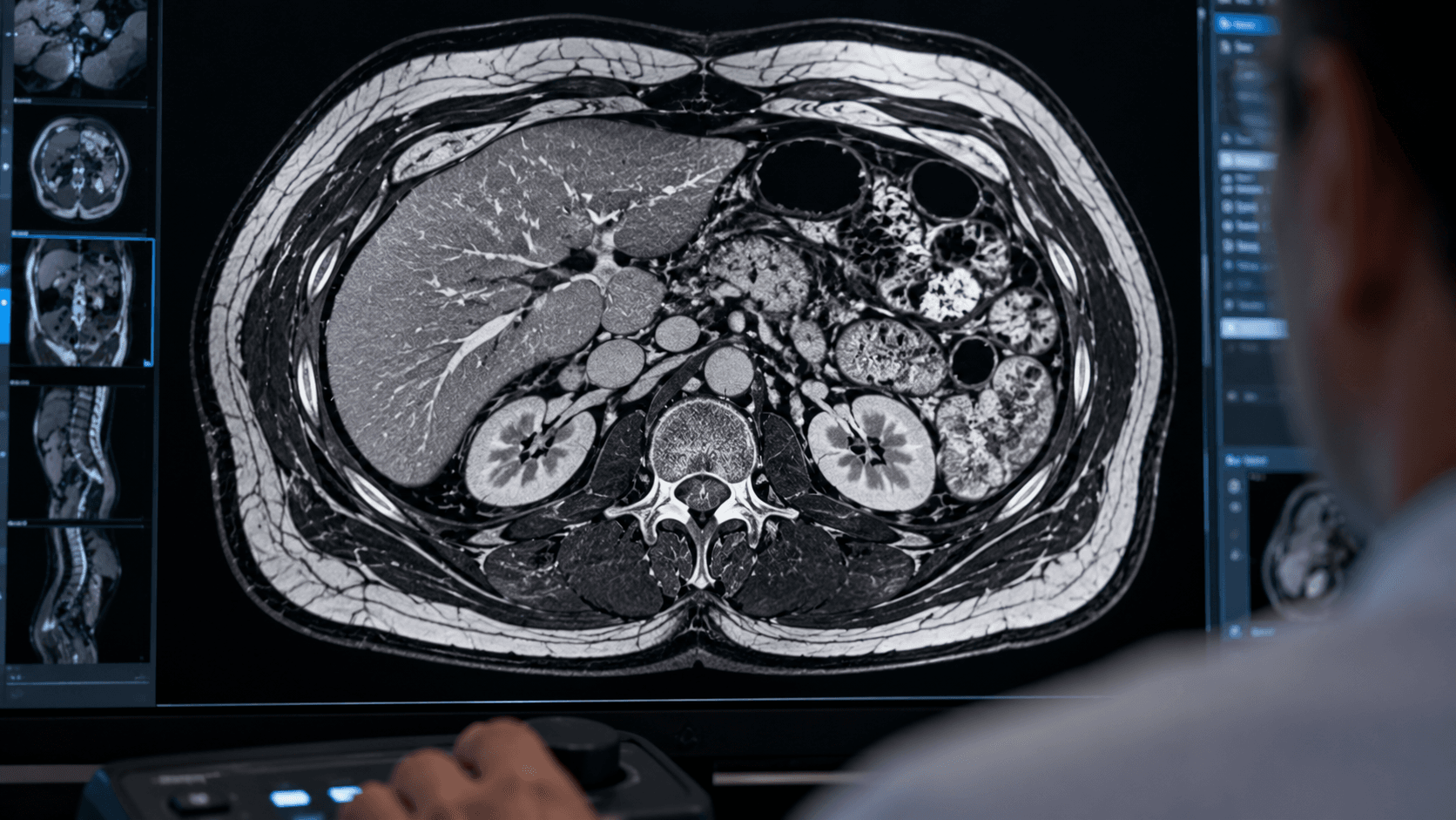 What Home Health Measurements Can Reveal About Metabolic Risk