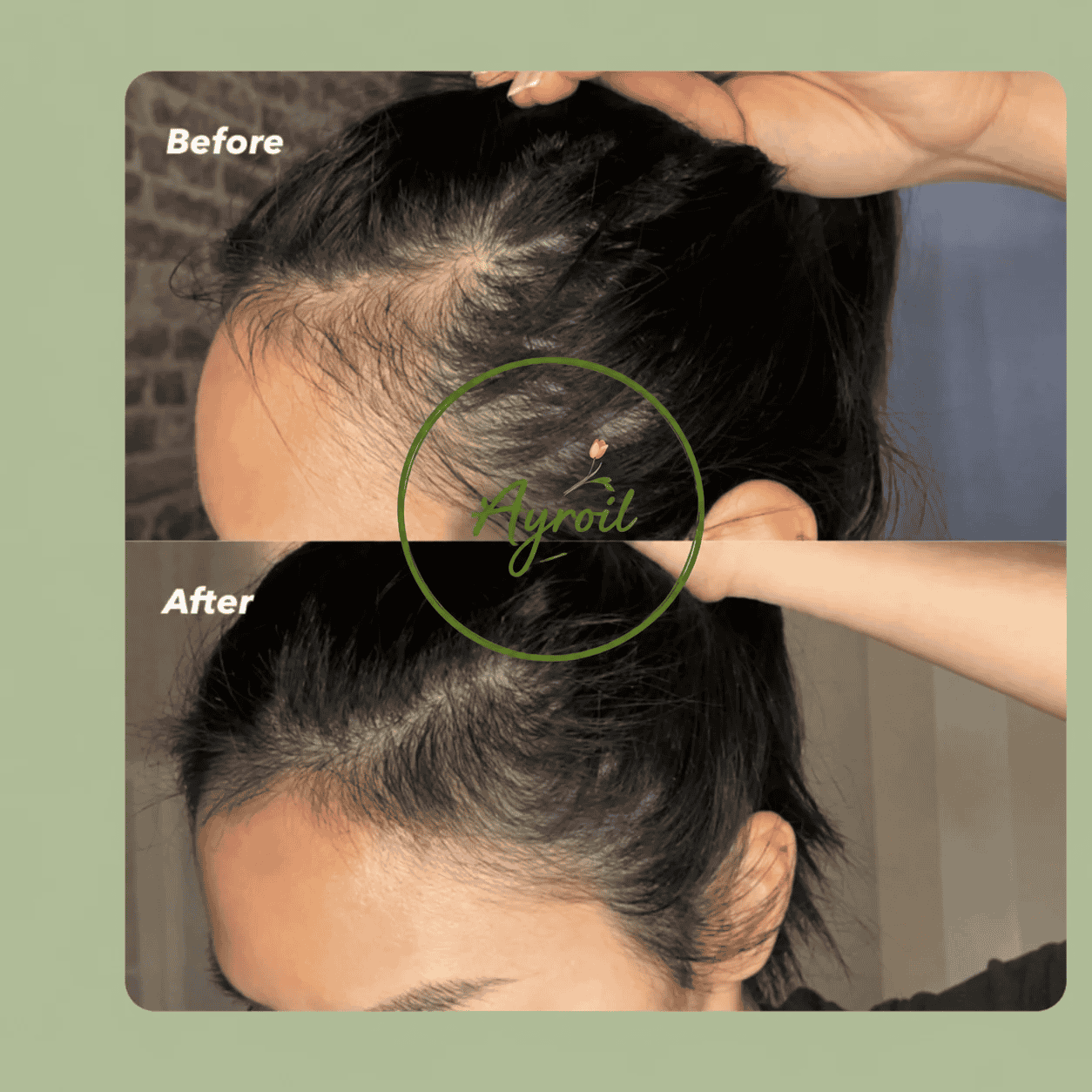 Ayroil Nourishing Hair Oil - 180ml