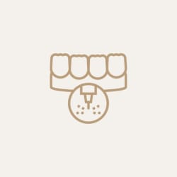 کانتورینگ لیزری دندان