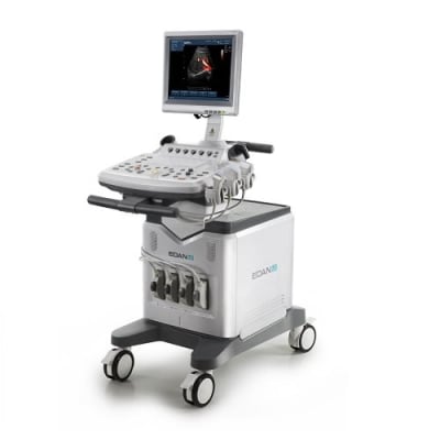 EDAN U2 Prime Edition Portable Color Doppler Ultrasound System by EDAN Bangladesh — MediportBD (হাসপাতাল মেশিন)