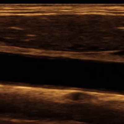 MINDRAY DP-20 Portable Ultrasound with Convex Probe by Mindray front view Bangladesh — MediportBD (হাসপাতাল মেশিন)