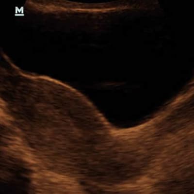 MINDRAY DP-20 Portable Ultrasound with Convex Probe by Mindray front view Bangladesh — MediportBD (হাসপাতাল মেশিন)