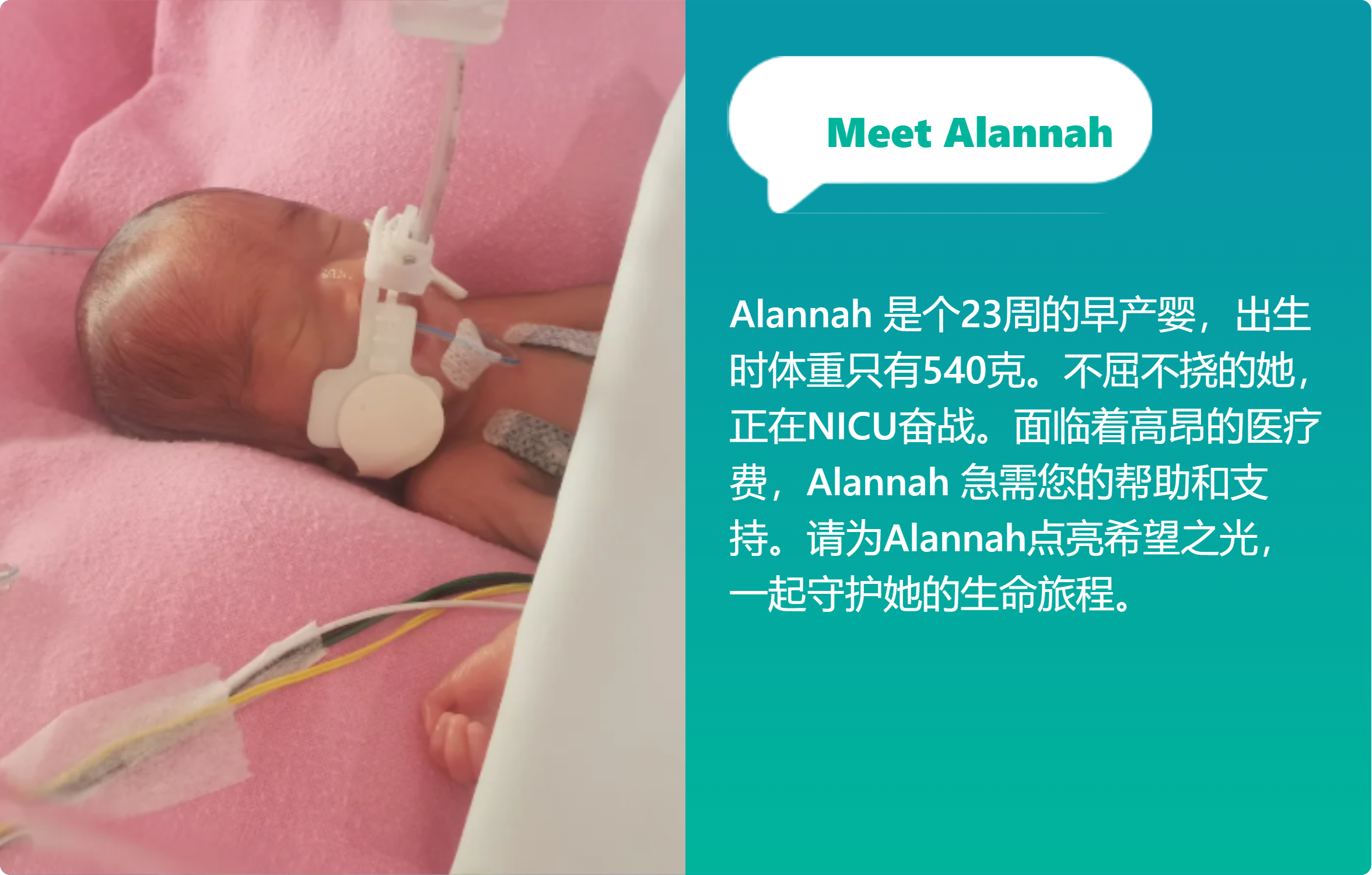 Urgent] Help Micro Preemie Baby Alannah Go Home - [Big Heart for Little  Ones]