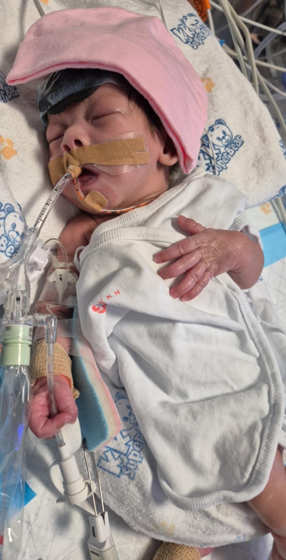 Help My Baby Zhi En Recover After Heart Surgery and RSV Complications