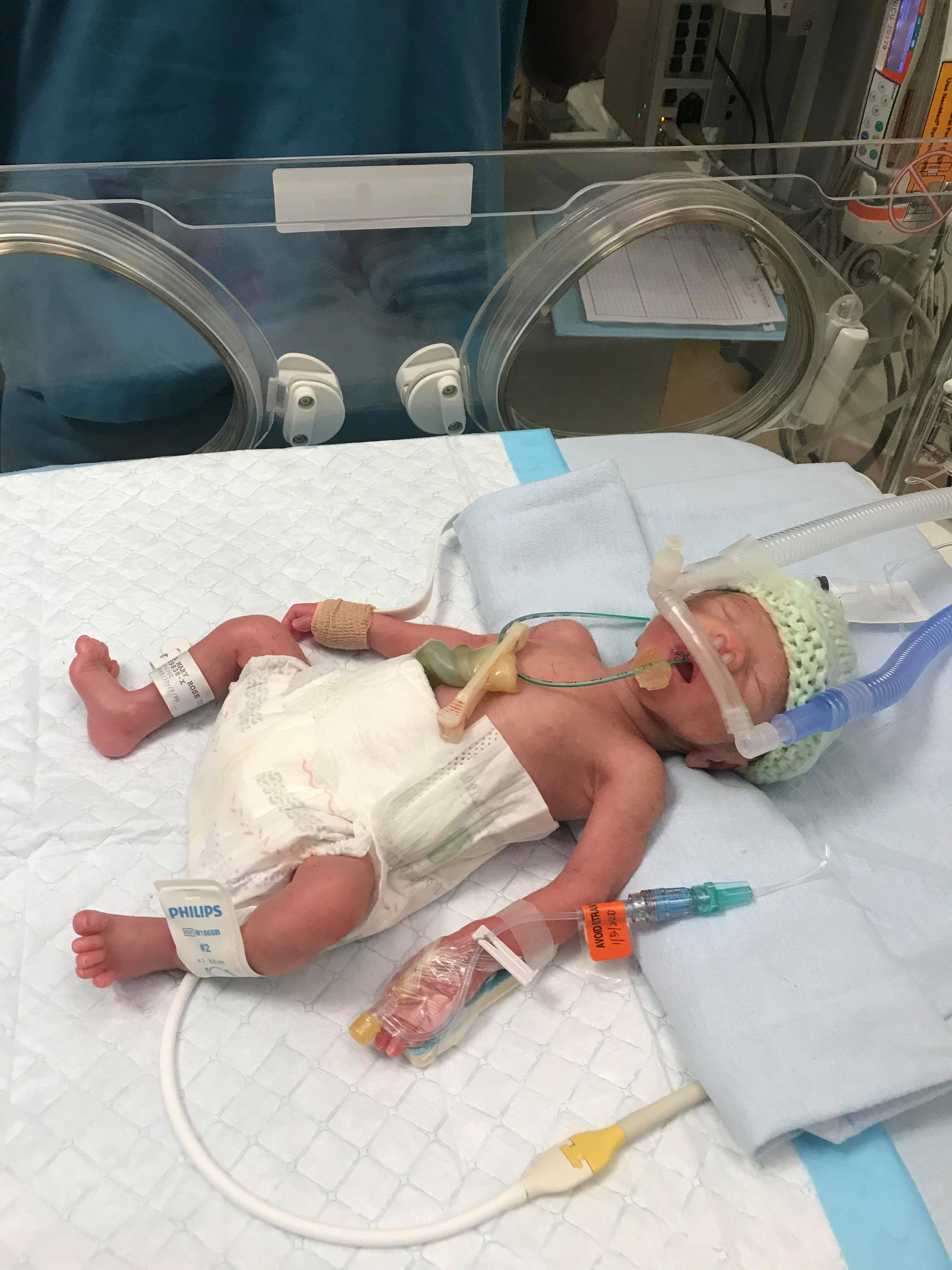 28 week discount old premature baby