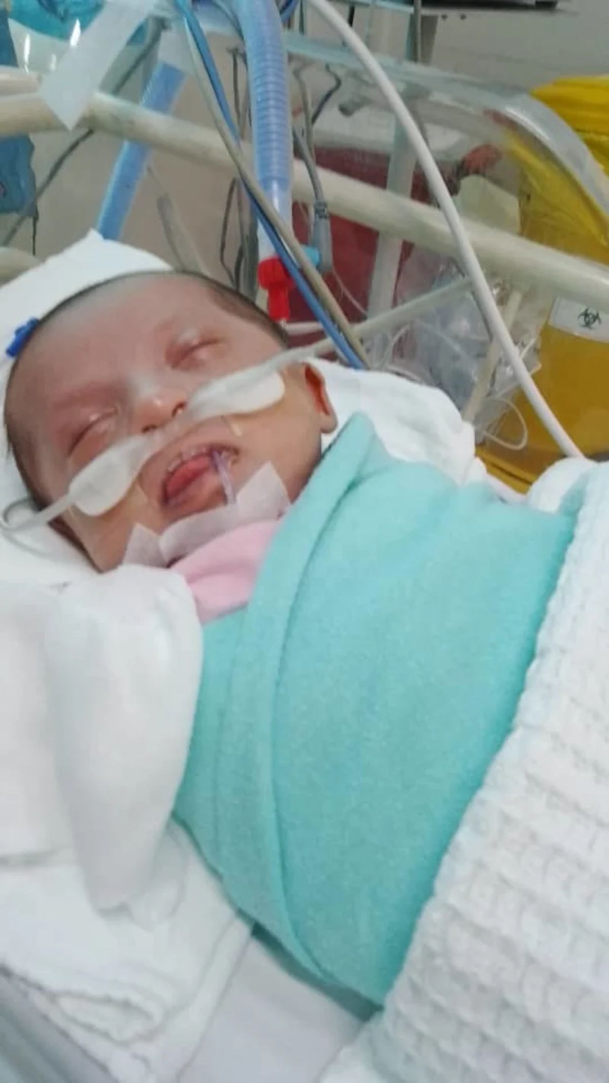 HELP 3MONTHS OLD BABY NOR SHAHIDAH FOR HER HEART SURGERY