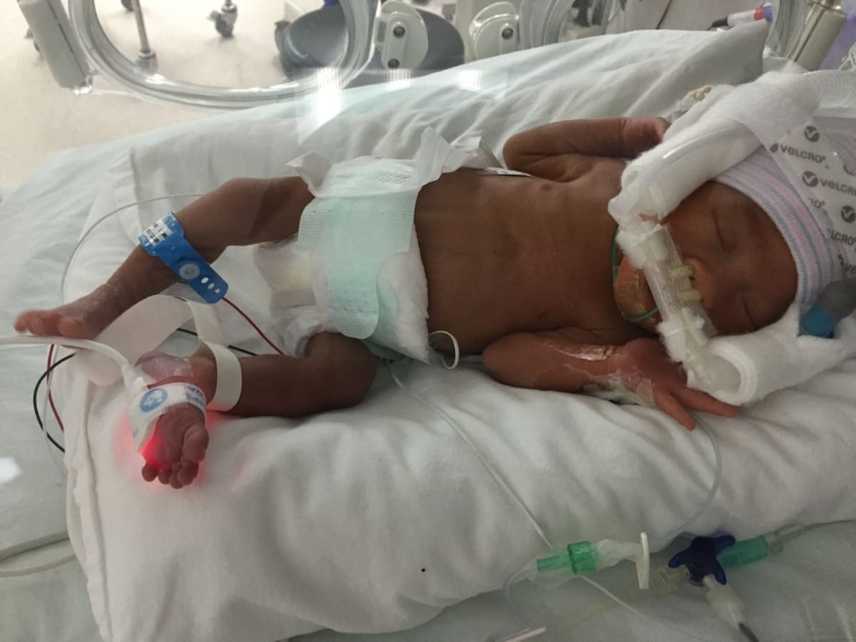 7 month preemie