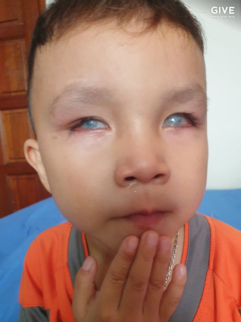 Save 4 Year Old Thai From Total Blindness