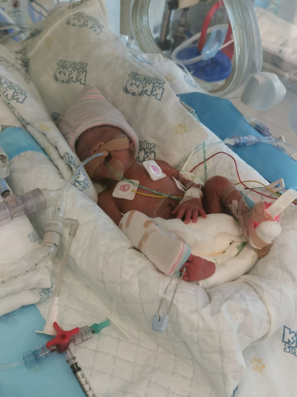 Help My Extreme Premature Baby Yong Chen [Big Heart for Little Ones]