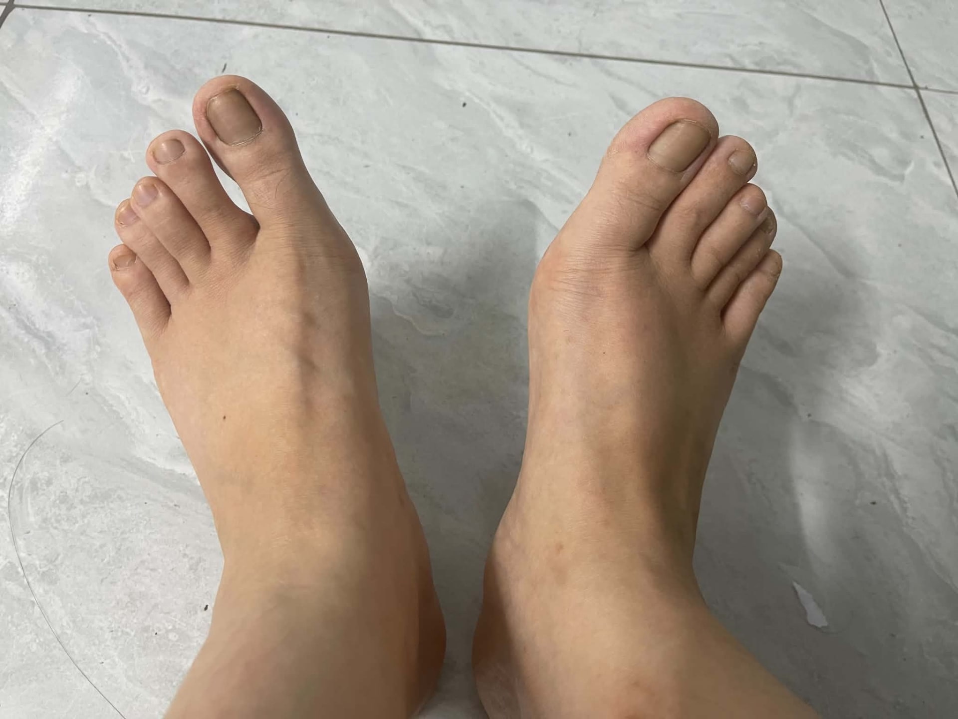 Ảnh 1.