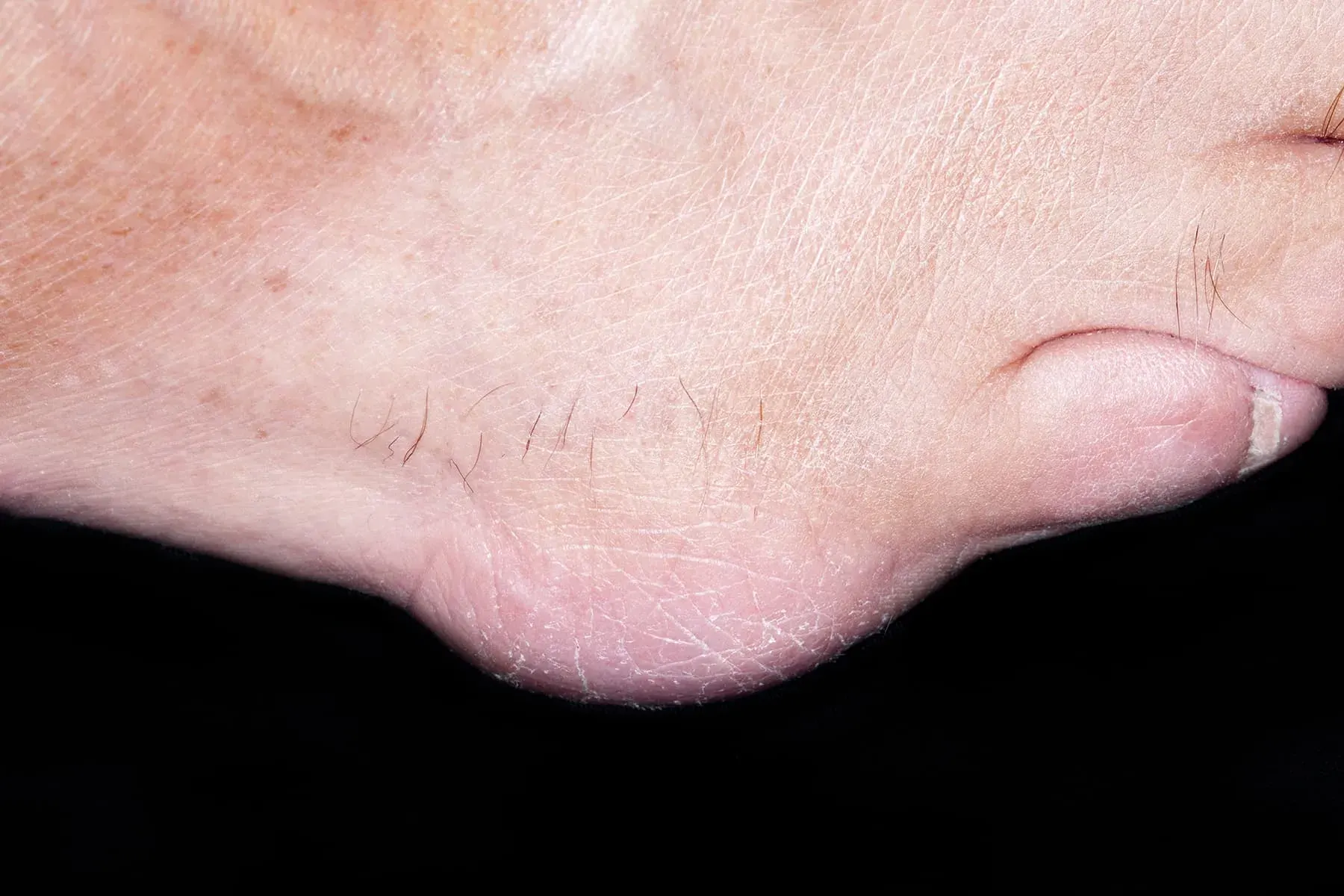 Ảnh 1.