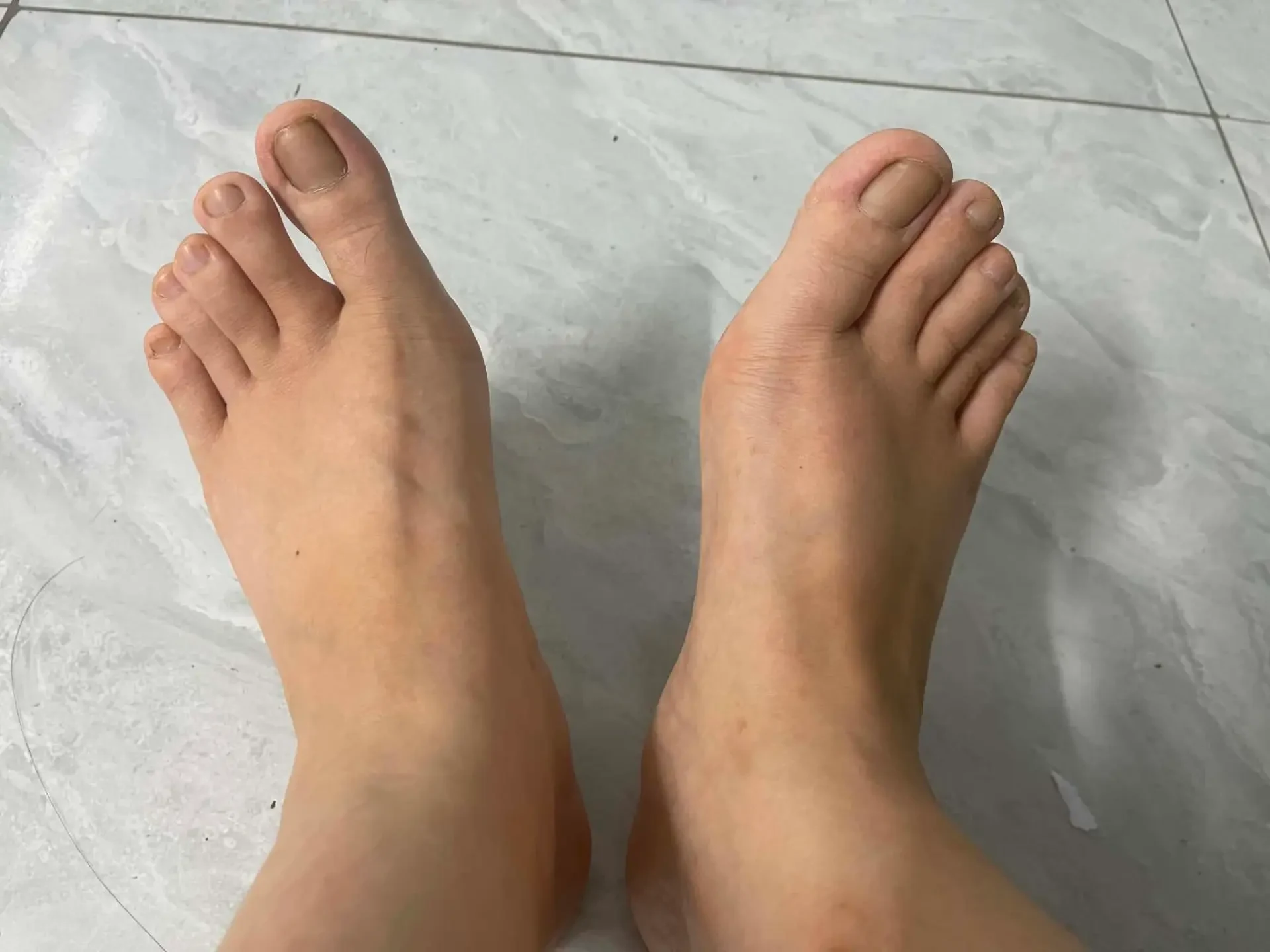 Ảnh 1.