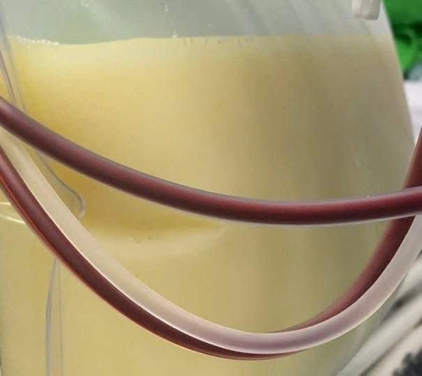 Ảnh 1.