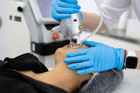CO₂ Laser Treatment