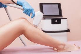 Diode Laser Hair Reduction