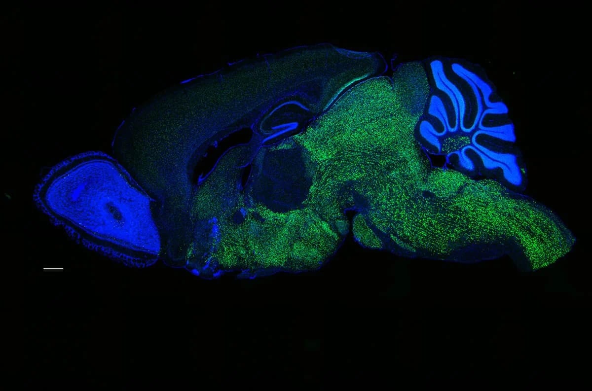 Imagen microscópica que muestra la proteína NOVA1 en neuronas de un ratón.