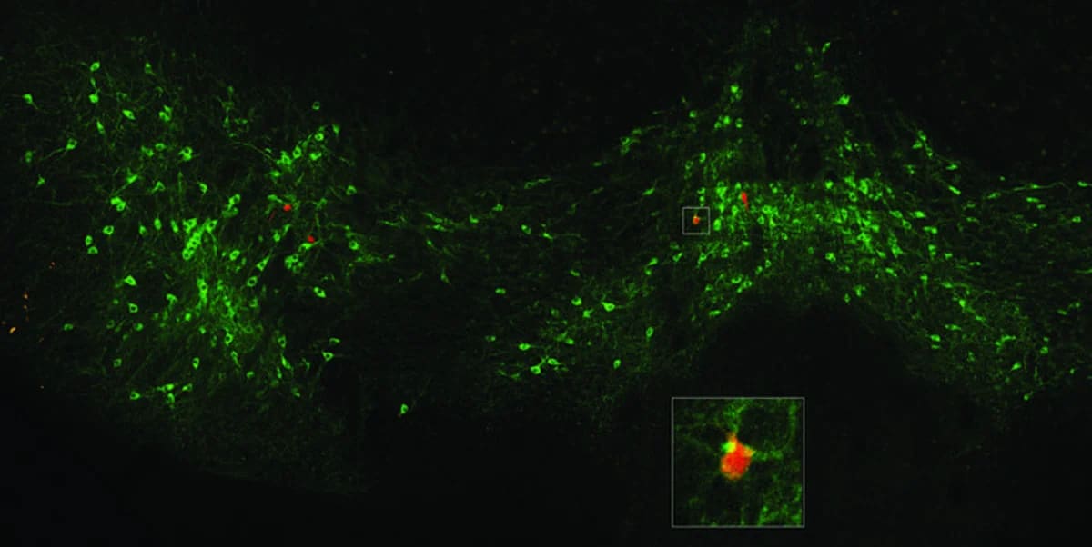 Neuronas dopaminérgicas del área tegmental ventral conectadas a la amígdala posterior, destacadas en verde y rojo.