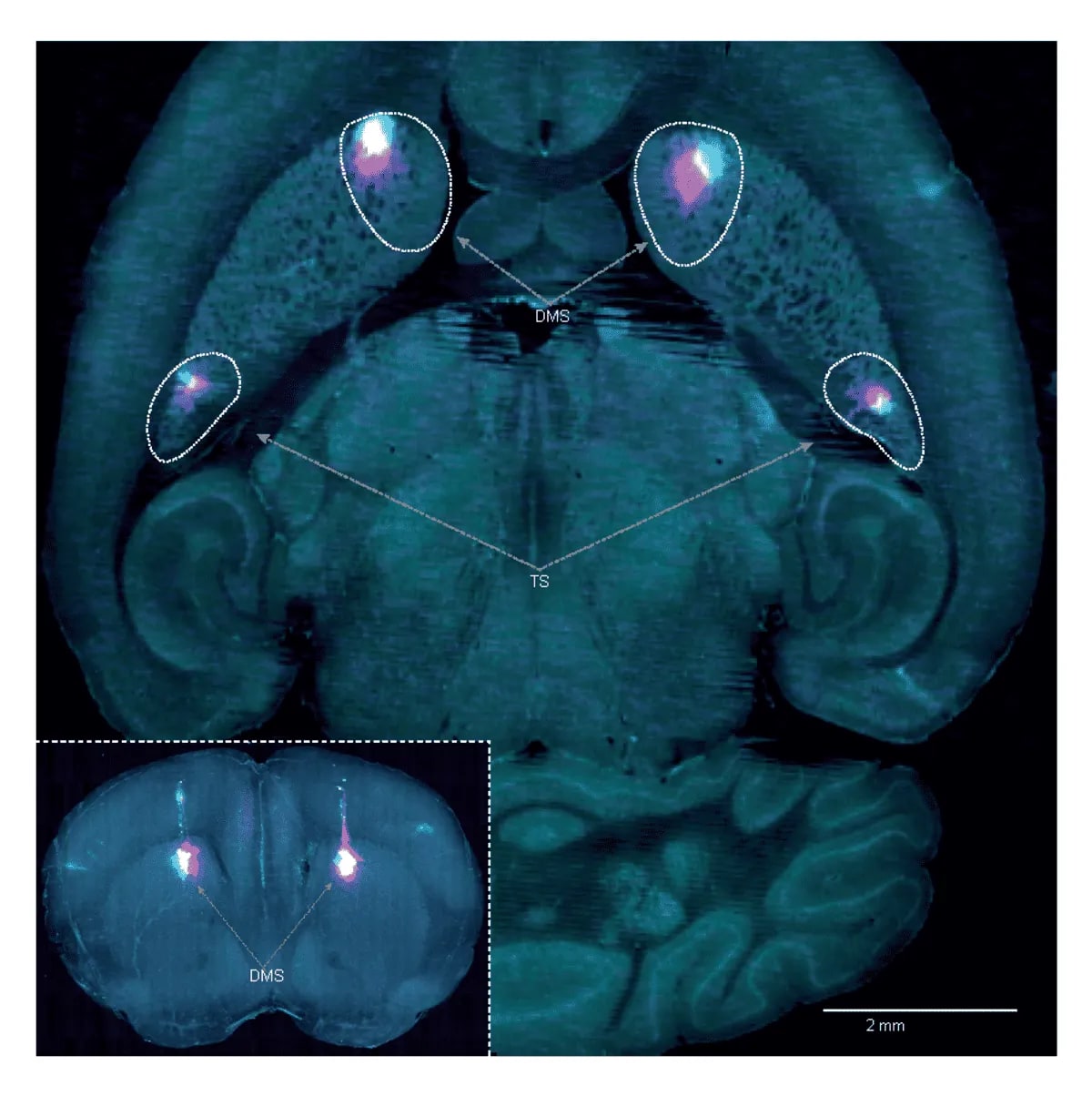 Secciones del cerebro con regiones DMS y TS resaltadas con fluorescencia