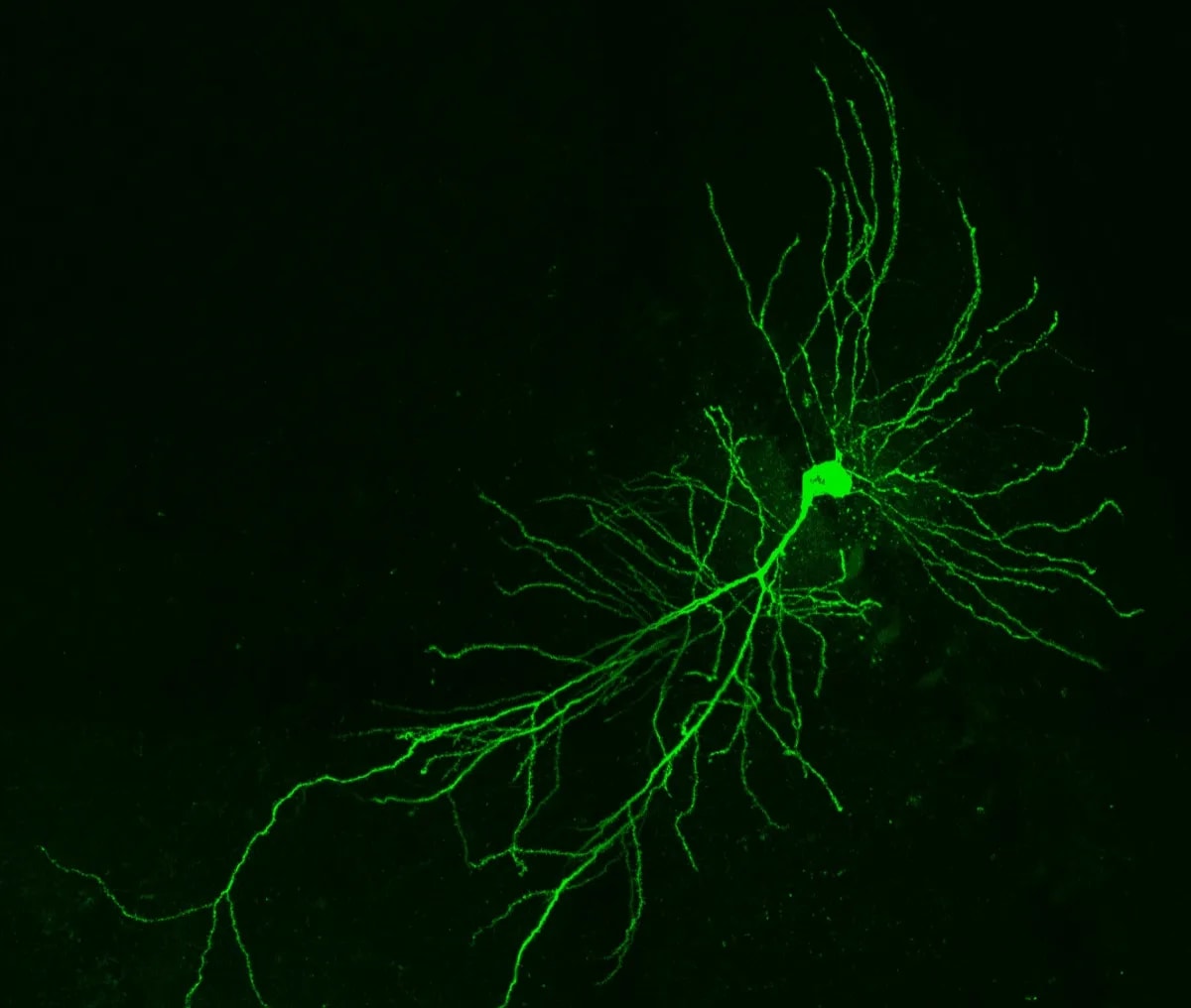 Neuronas sanas de ratón en el hipocampo