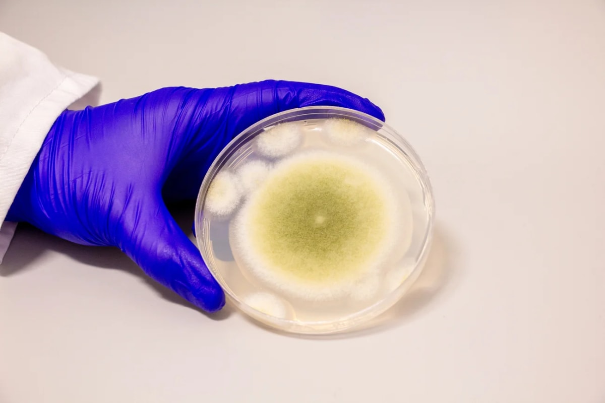 Placa de Petri con cultivo de Aspergillus flavus desarrollándose en el Laboratorio Gao