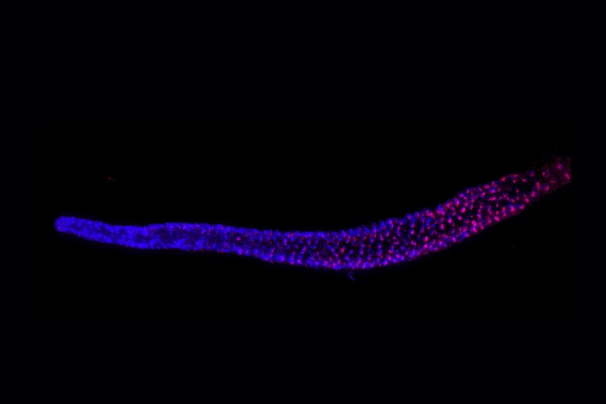 Visualización microscópica del ARN telomerasa terc-1 en los núcleos de la línea germinal de C. elegans
