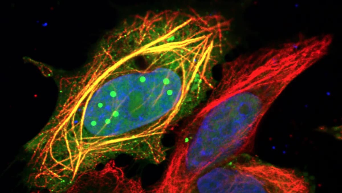 Células humanas con proteína P3 del virus de la rabia observadas al microscopio confocal