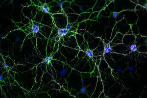 Red de neuronas humanas observada mediante microscopía