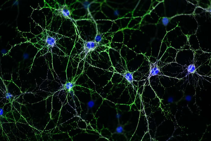 Red de neuronas humanas observada mediante microscopía