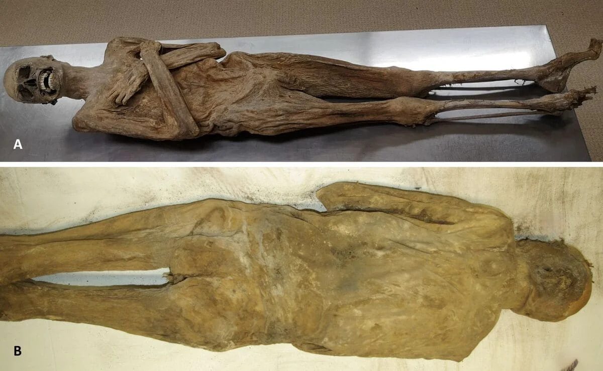 Vista frontal y dorsal de la momia austriaca con abdomen intacto