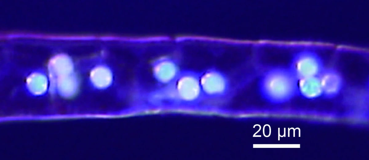 Células glandulares de alga roja con microesferas reflectantes de luz azul