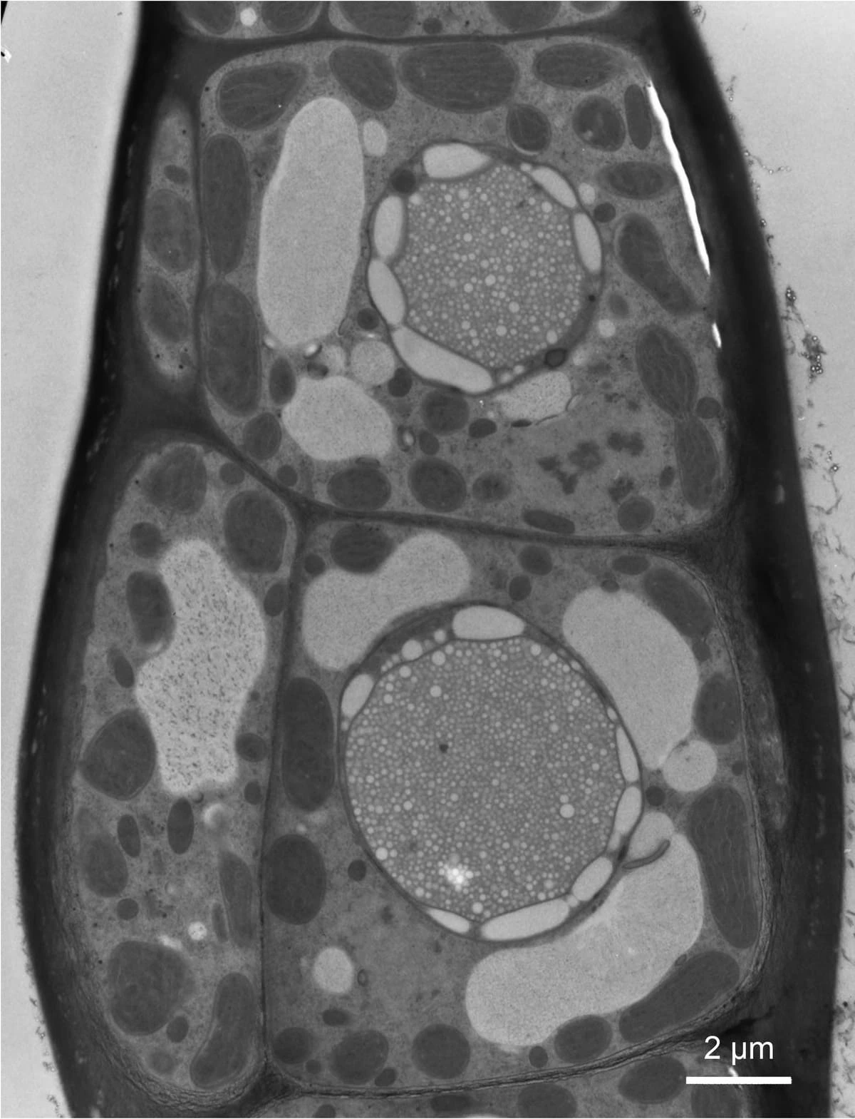 Micrografía electrónica de células internas de Asparagopsis taxiformis