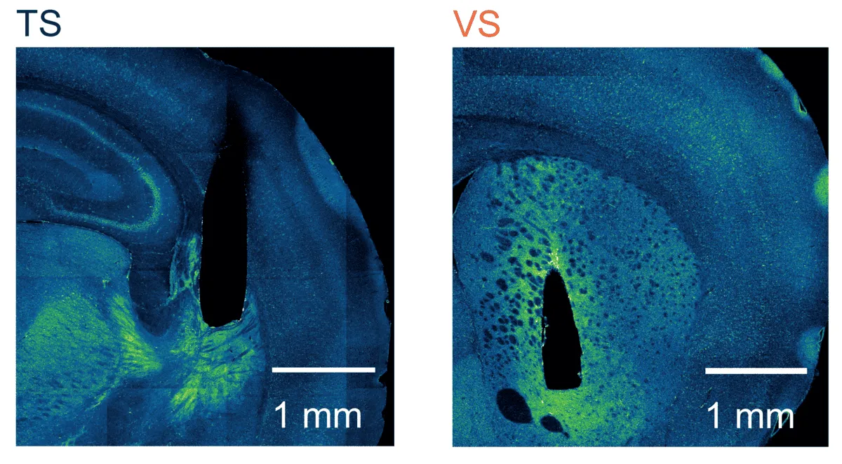 Imágenes fluorescentes del cerebro con etiquetas TS y VS