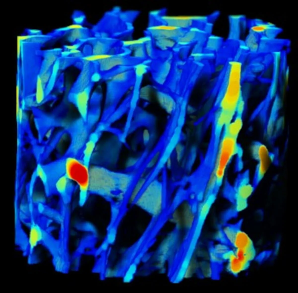 Reconstrucción 3D por rayos X del cartílago intermedio de un tiburón de puntas negras.