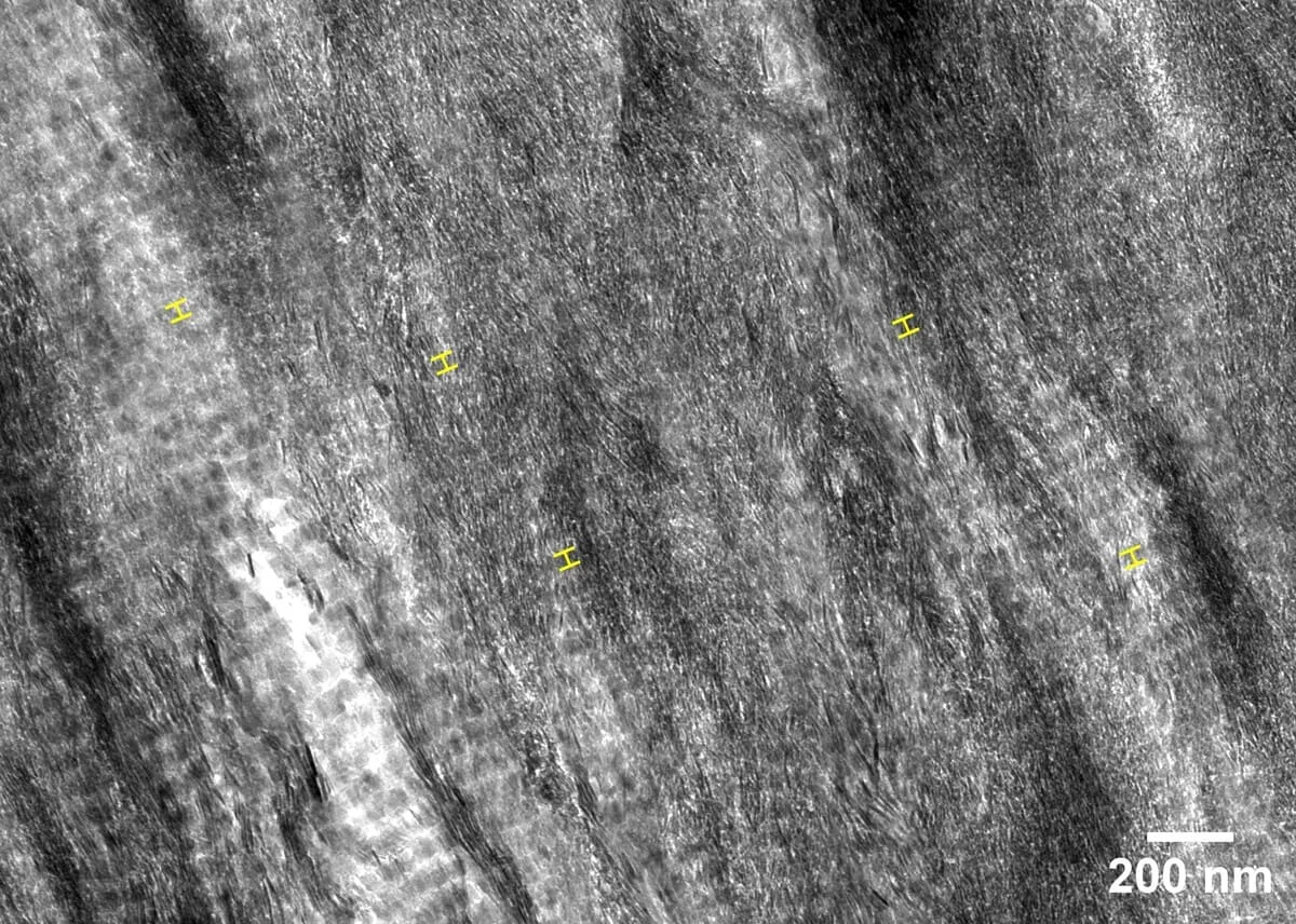 Detalle de regiones mineralizadas en el cuerpo calcáreo del tiburón de puntas negras.