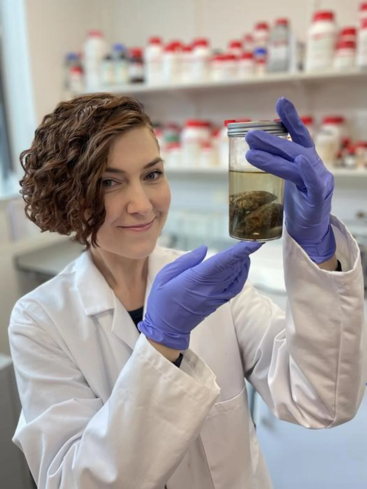 Alexandra Morton-Hayward sostiene dos hemisferios cerebelosos conservados en formalina
