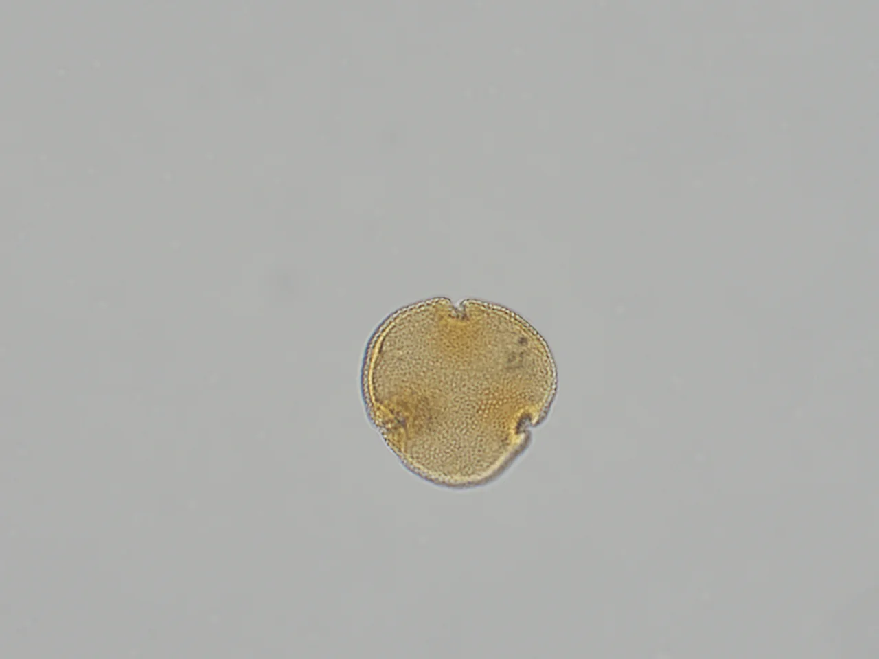 Polen fósil de Tilia magnasepala visto al microscopio óptico mostrando su morfología