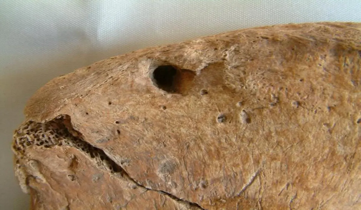 Primer plano de un hueso de cadera con una marca circular atribuida al diente de un león