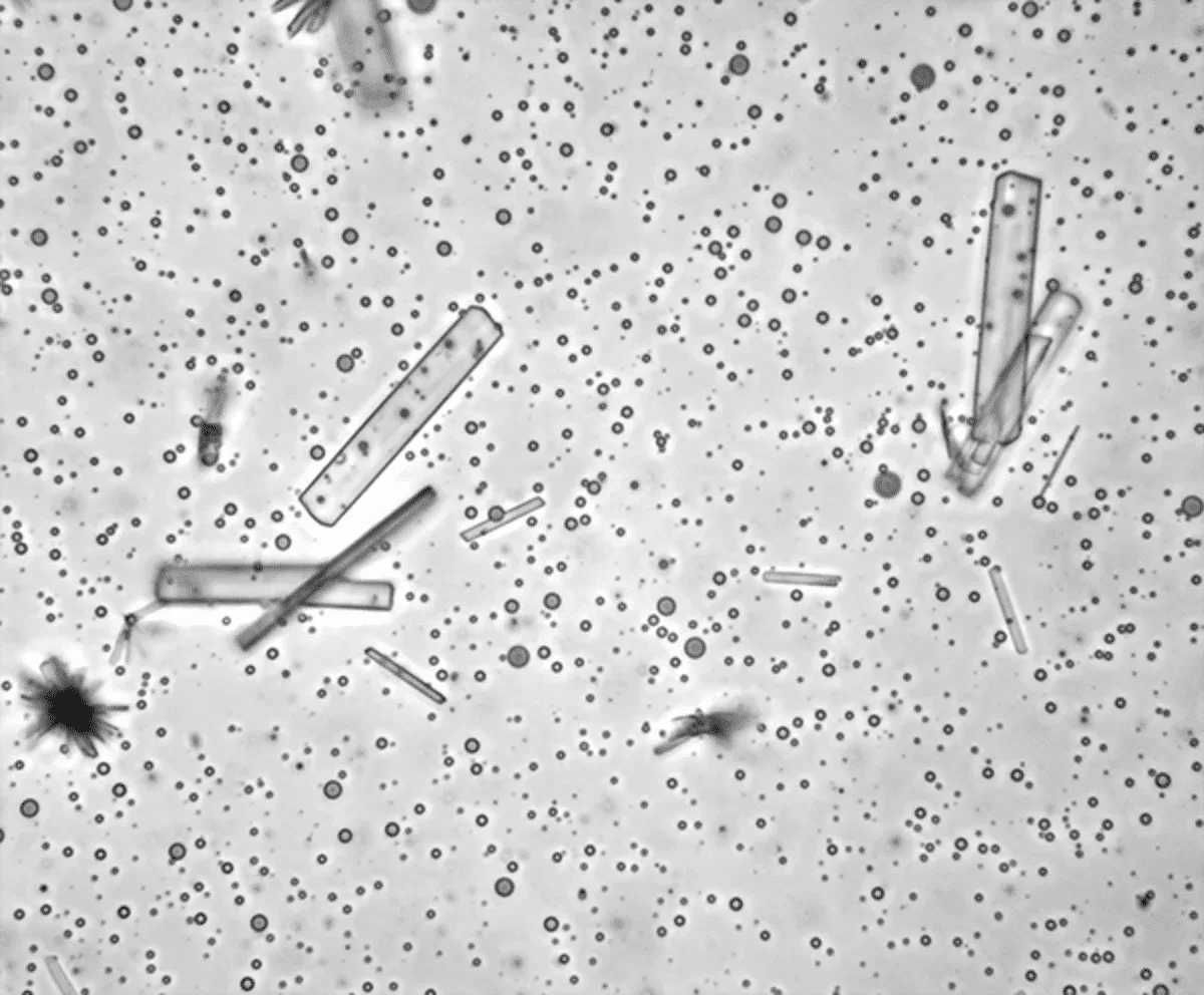 Cristales de tartrato de calcio junto a microgotas de poliéster en condiciones prebióticas.