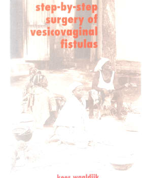 step by step obstetric fistula surgery cover