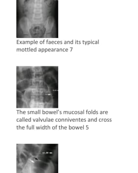 OSCE 2 cover